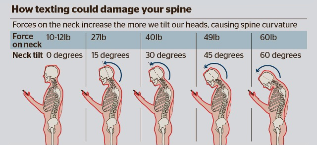 TEXT-NECK